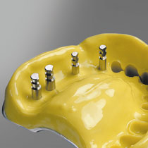 Detaseal® hydroflow putty - odtlačková hmota