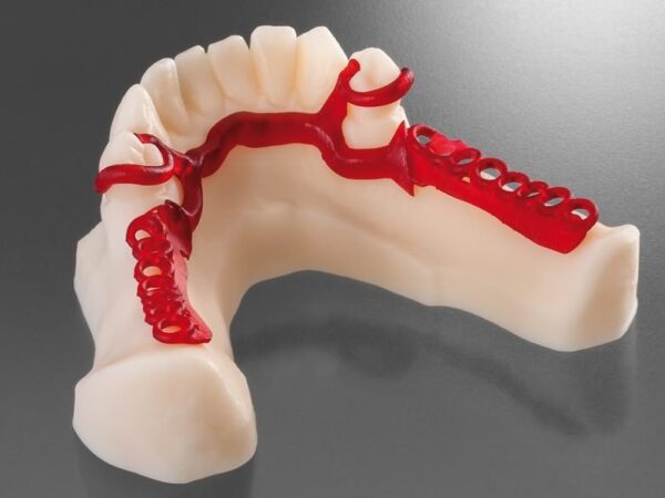FREEPRINT® cast - Image 4