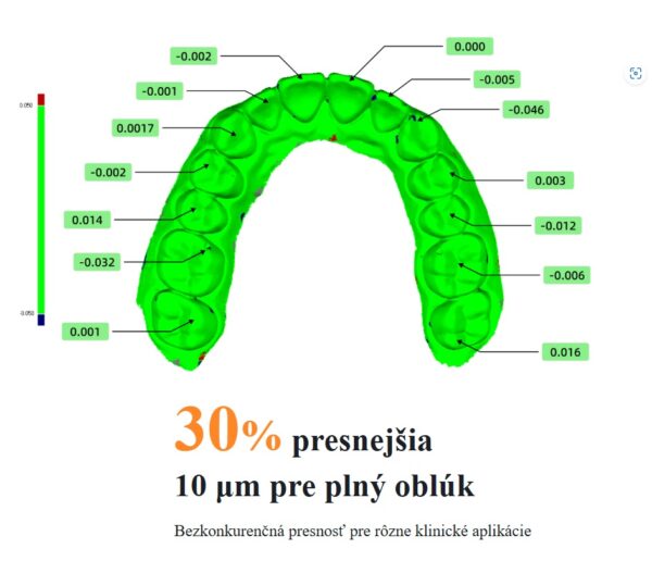 3D intraorálny skener - Image 3